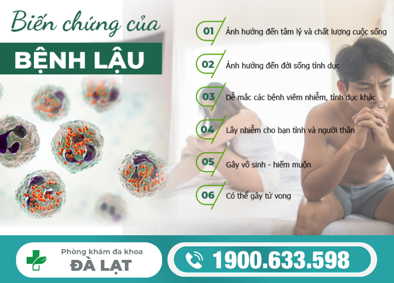 Hình ảnh minh họa